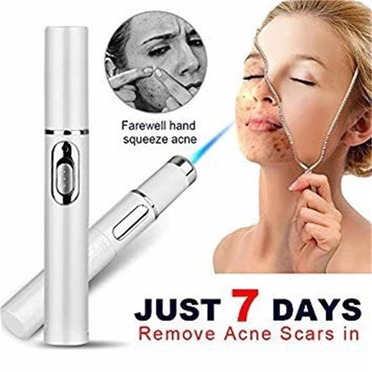 Blue Light Therapy Acne Pen – Laser Device for Scar & Wrinkle Removal | Skin Care Beauty Tool